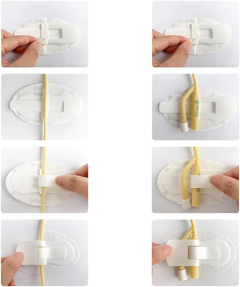 4 Pcs Adhesive Catheter Stabilization Device with Foam Anchor Pad L5897